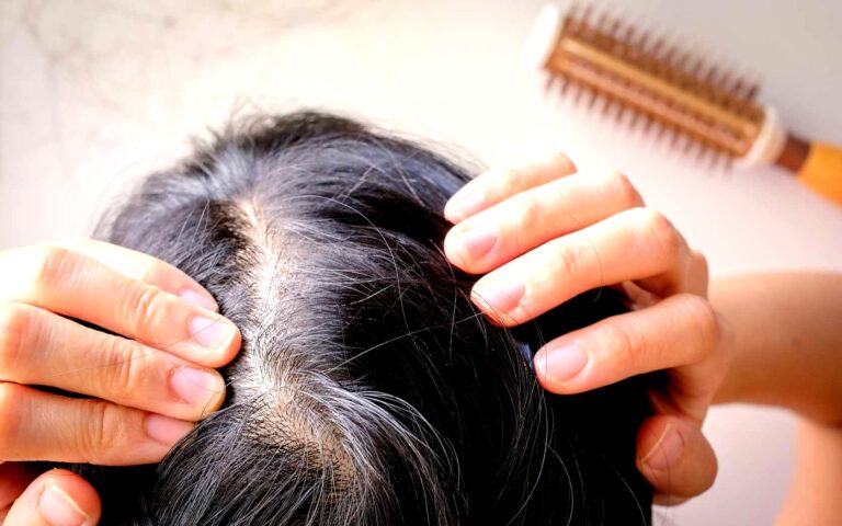 tamo-ristorante-perche-applicare-bicarbonato-di-sodio-e-rosmarino-sui-capelli-grigi-e-come-farlo-in-