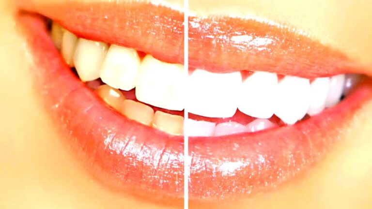 tamo-ristorante-questi-rimedi-naturali-per-sbiancare-i-denti-senza-prodotti-chimici-sono-usati-da-mo